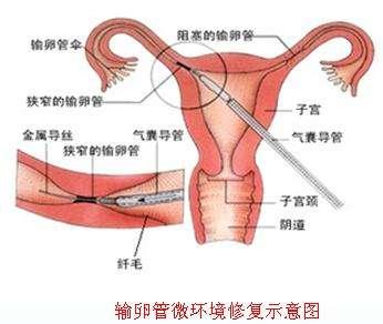 通草的功效与作用能通输卵管堵塞,高速响应计划实施_高级款41.765